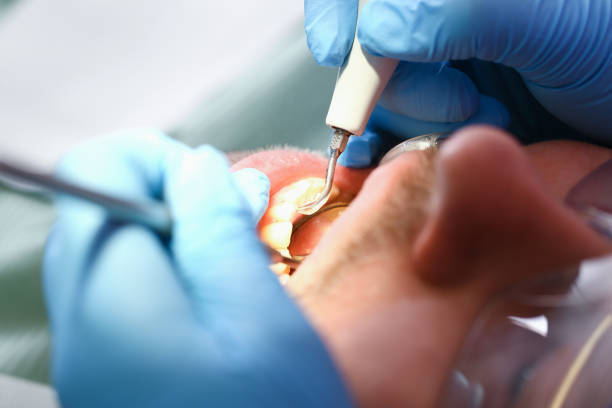 Best Emergency Treatment for Oral Infections in Chesaning, MI